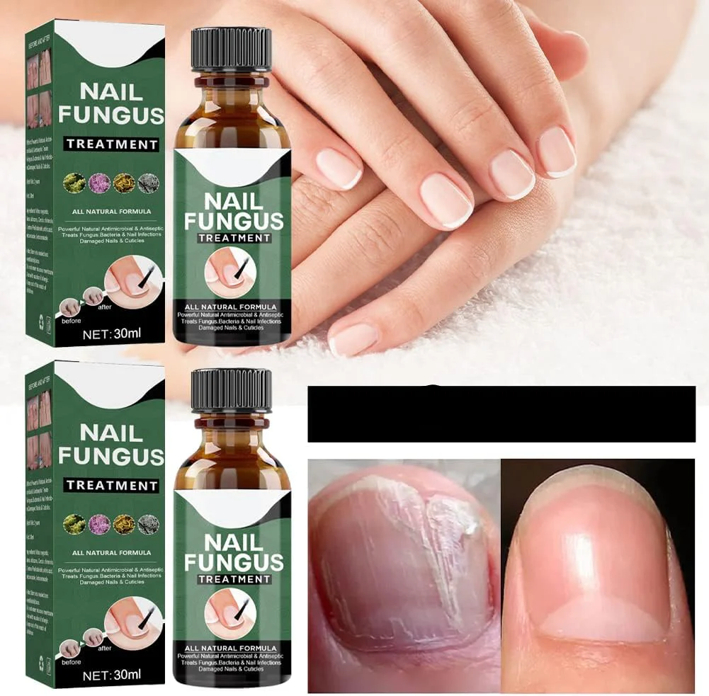 ClearRoot - Regrow Healthy, Pristine Nails Fast + 50% OFF