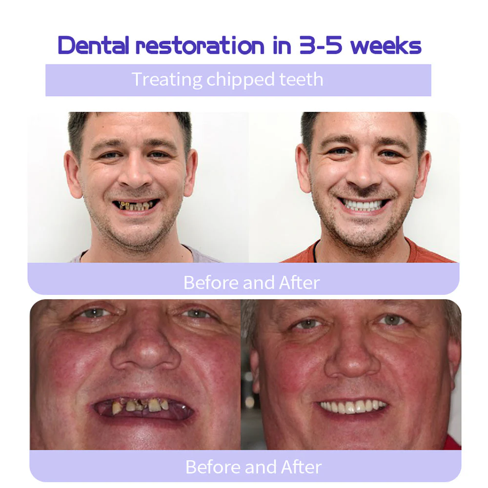 Odalit – Rebuild Gums & Save Teeth + 50% OFF - Image 10
