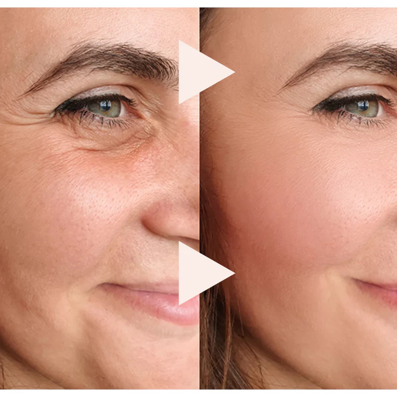 The 10-Second Wrinkle Eraser - An Instant Lift in a Stick + 50% OFF - Image 3